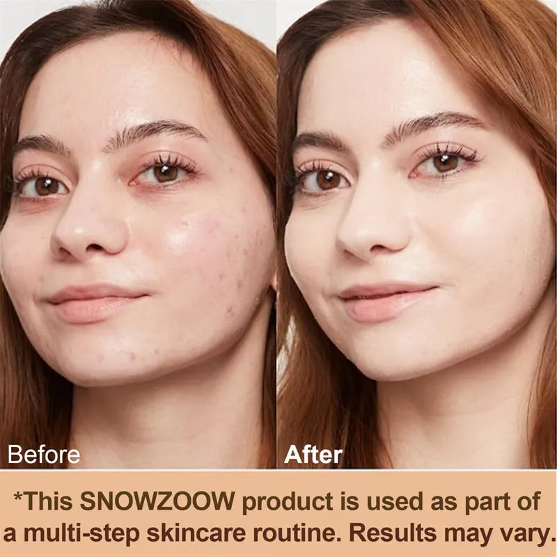 💖 Achieve Flawless Skin ✨Foundation 4 in 1 - Light Spectrum